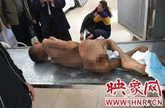9岁男童走失半年饿死救助站 发现时成“干尸”